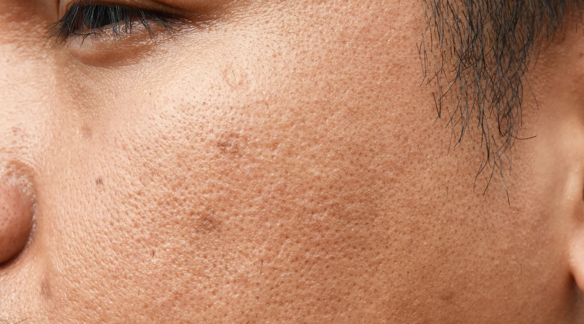 بهترین روتین پوستی برای پوست چرب - یک راهنمای کاربردی