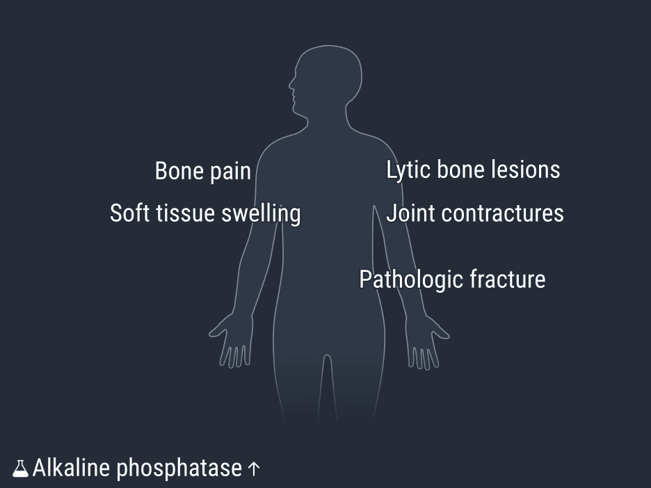 بیماری گورهام