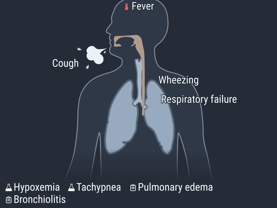 آسپیراسیون اسید معده